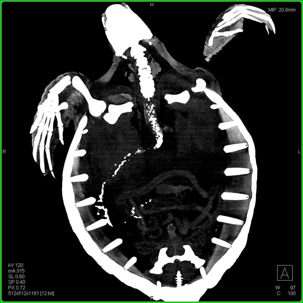 Turtle with Esophagitis - CTisus CT Scan