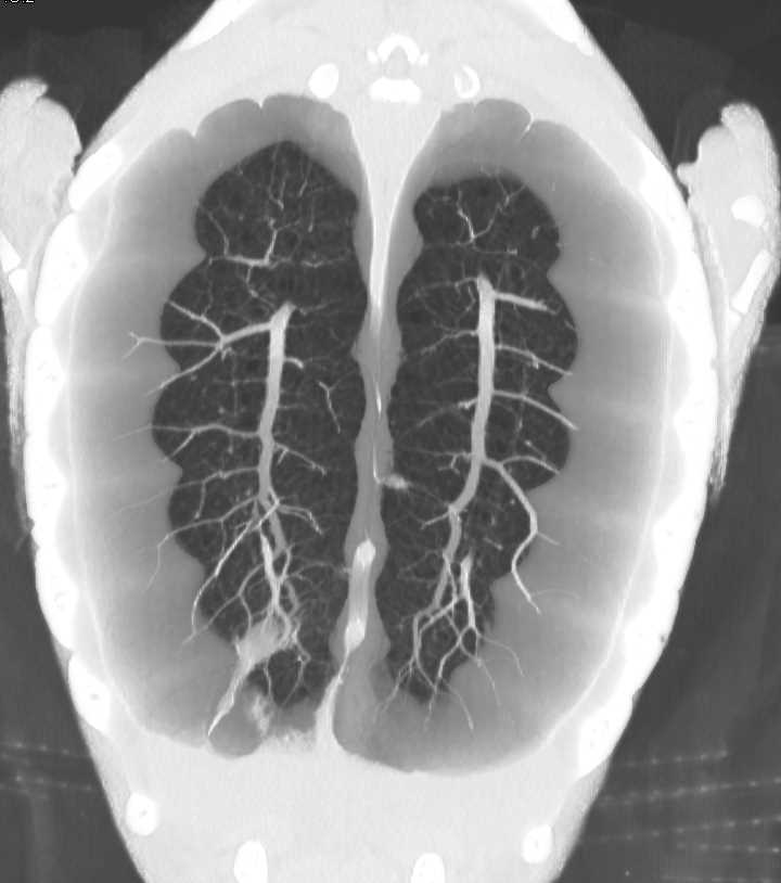 CT Turtle with Nice Lung 3D - CTisus CT Scan