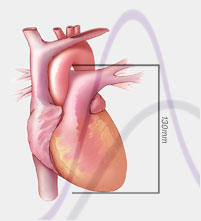 CTisus CT Protocols